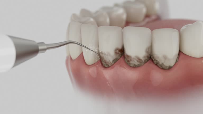 Reliable Dental Implants contractor in Wickliffe, OH by Smile Center Dentistry